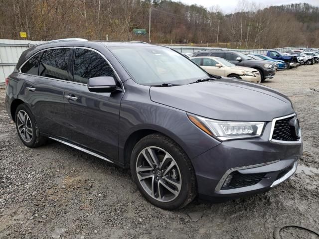 2017 Acura MDX Advance