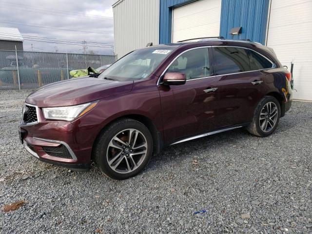 2017 Acura MDX Technology