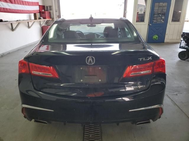 2019 Acura TLX Technology