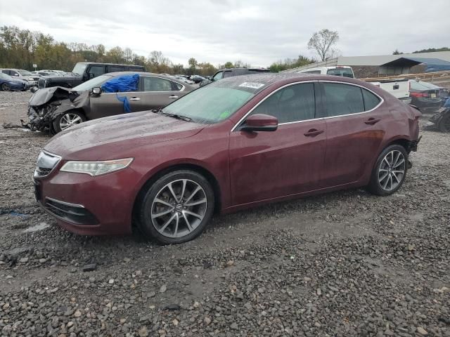 2016 Acura TLX Tech