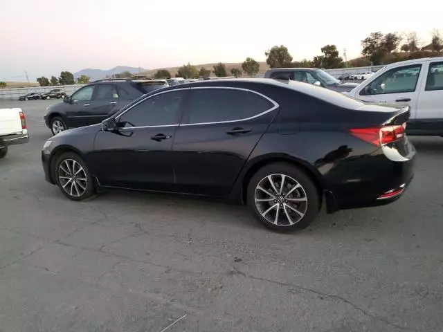 2015 Acura TLX Tech