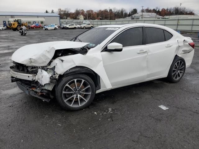 2016 Acura TLX Tech