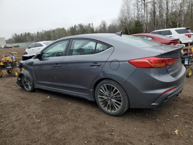 2017 Hyundai Elantra Sport