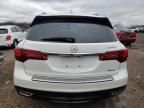 2015 Acura MDX Advance