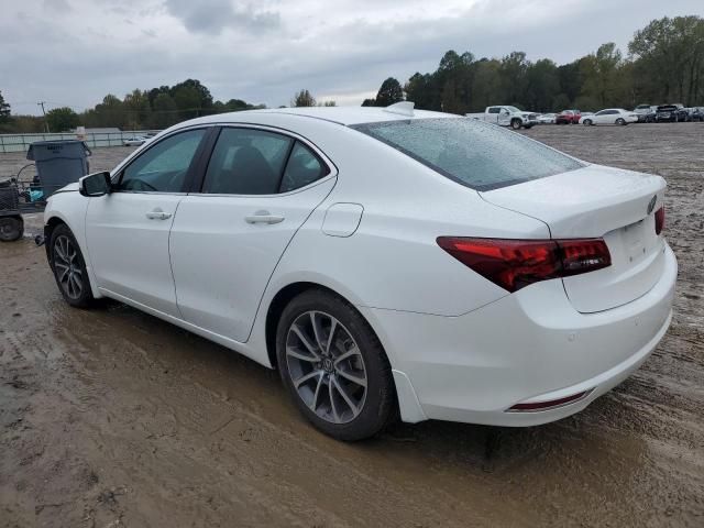 2017 Acura TLX Advance