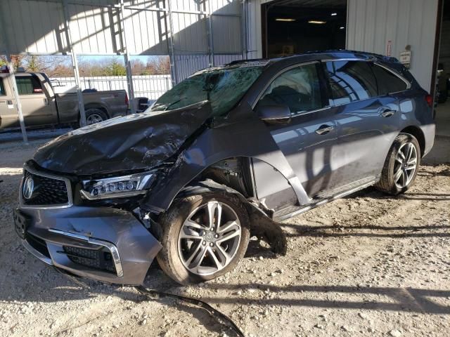 2017 Acura MDX Advance