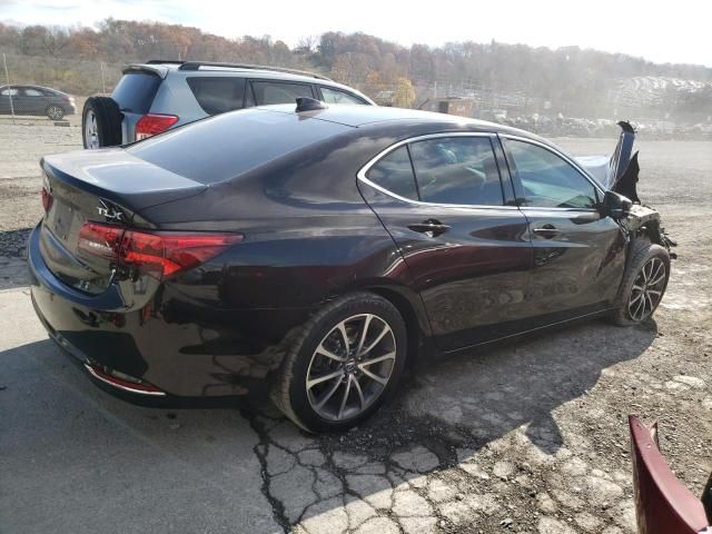 2017 Acura TLX Advance