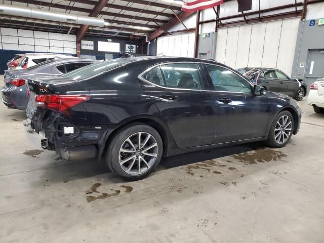 2017 Acura TLX Tech