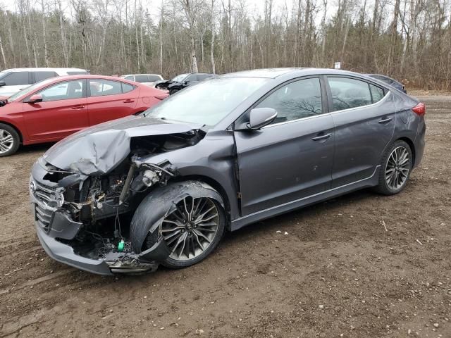 2017 Hyundai Elantra Sport