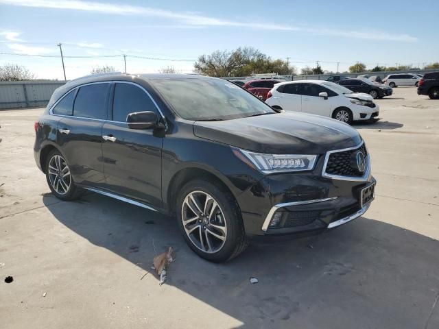 2017 Acura MDX Advance