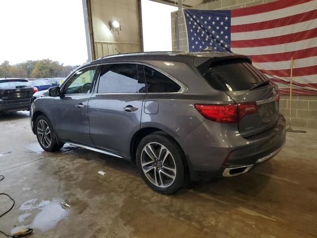 2017 Acura MDX Advance