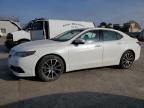 2017 Acura TLX Advance