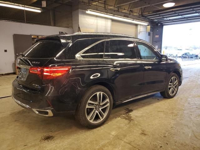 2017 Acura MDX Advance