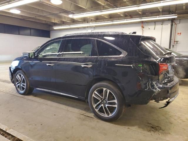 2017 Acura MDX Advance