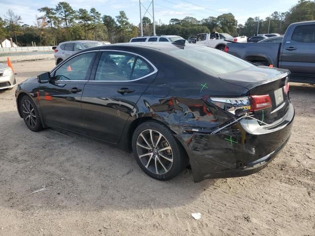 2015 Acura TLX Tech