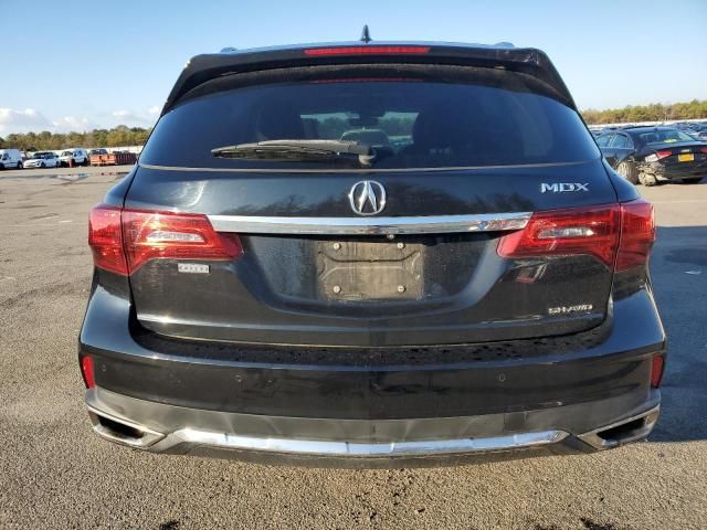 2017 Acura MDX Advance