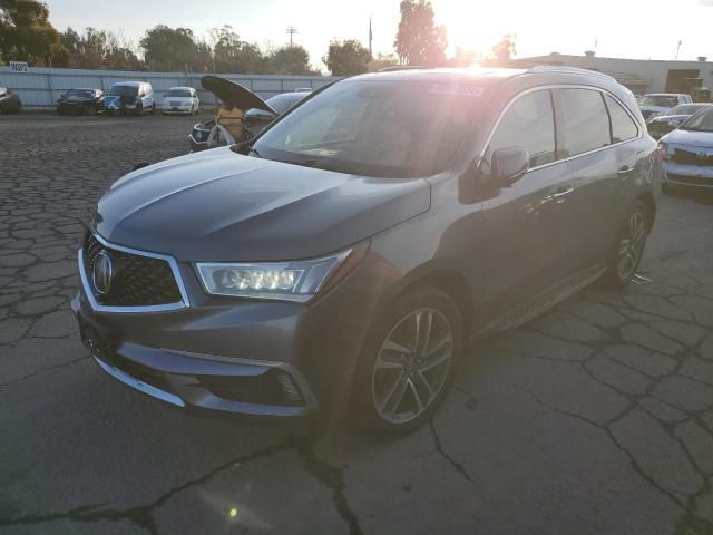 2017 Acura MDX Advance