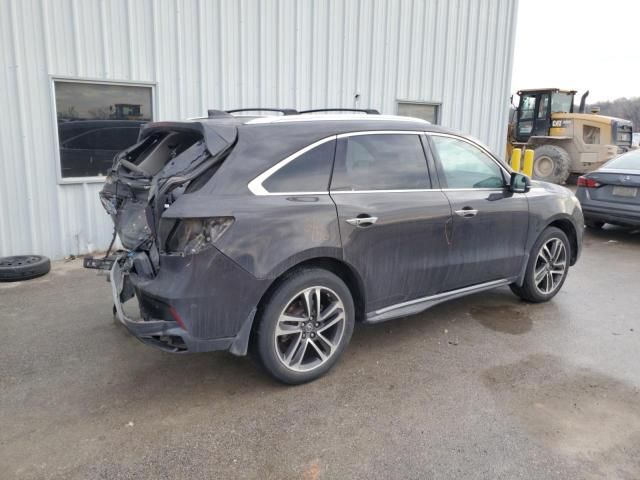 2017 Acura MDX Advance