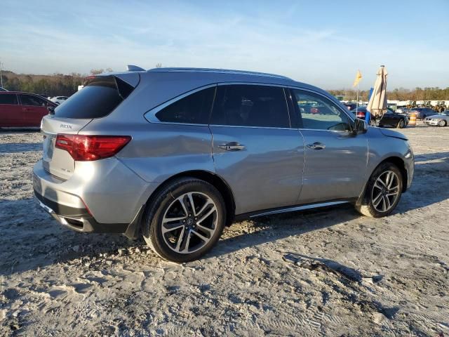 2017 Acura MDX Advance