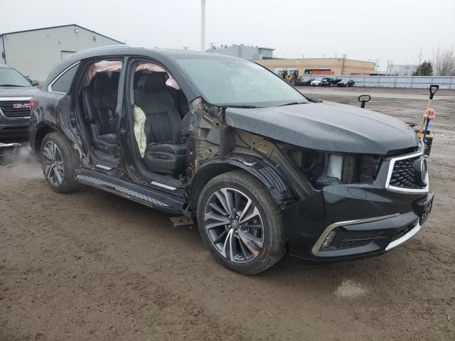 2017 Acura MDX Advance