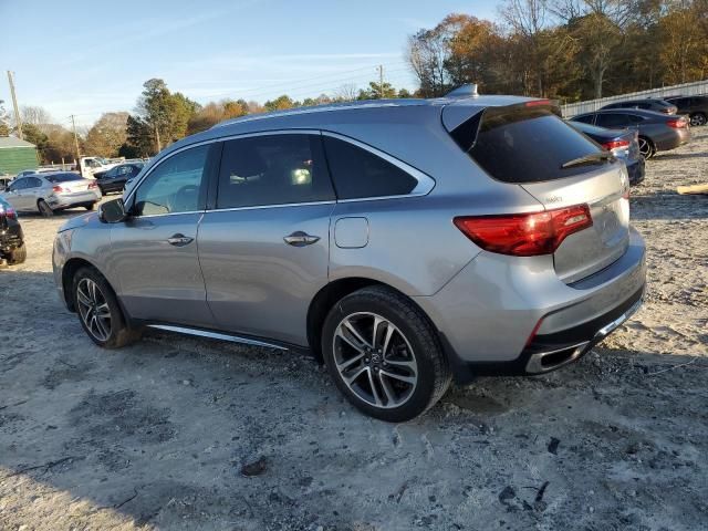 2017 Acura MDX Advance