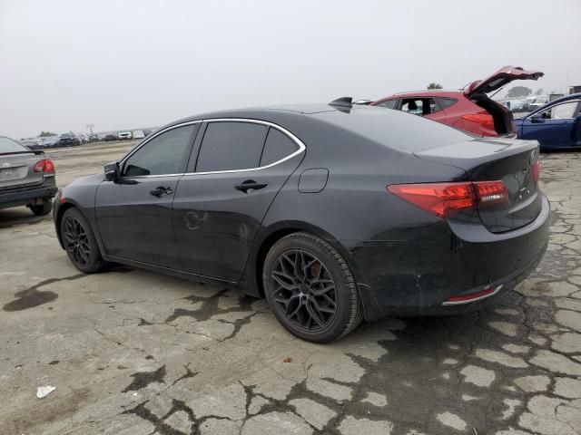 2015 Acura TLX Advance