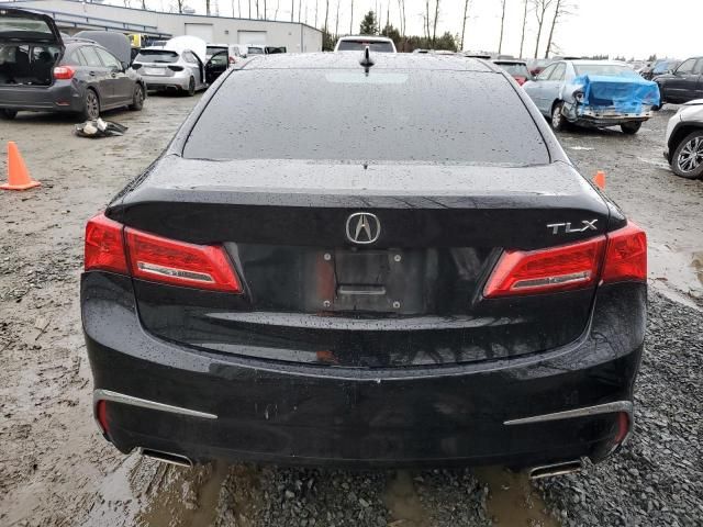 2018 Acura TLX Tech