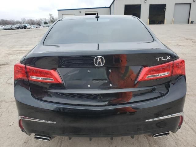 2019 Acura TLX Technology