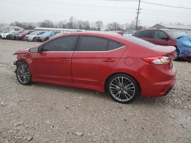 2018 Hyundai Elantra Sport