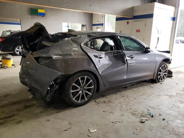 2017 Acura TLX Tech