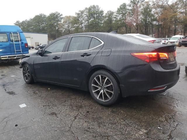 2015 Acura TLX Tech