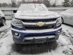 2015 Chevrolet Colorado Z71