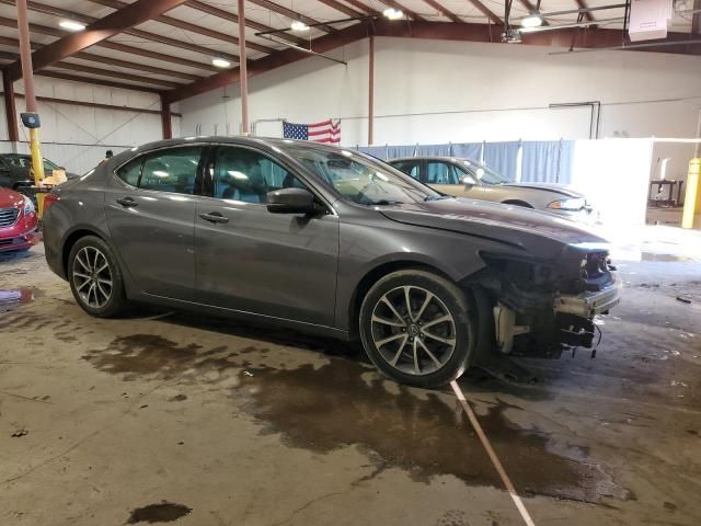 2017 Acura TLX Tech