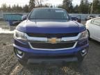 2017 Chevrolet Colorado LT