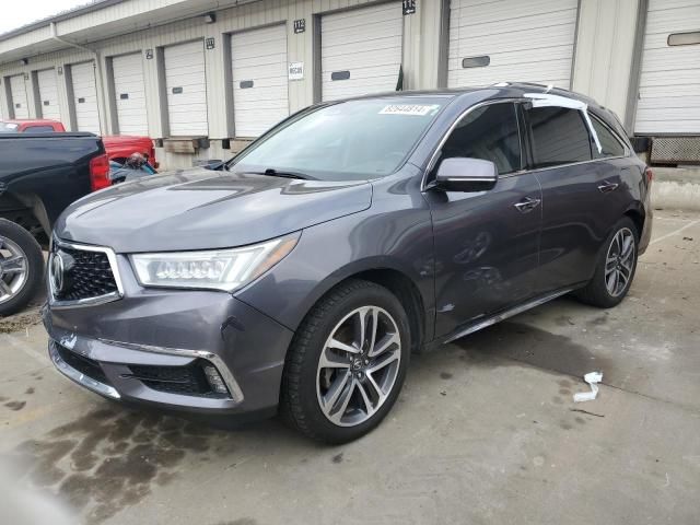 2017 Acura MDX Advance